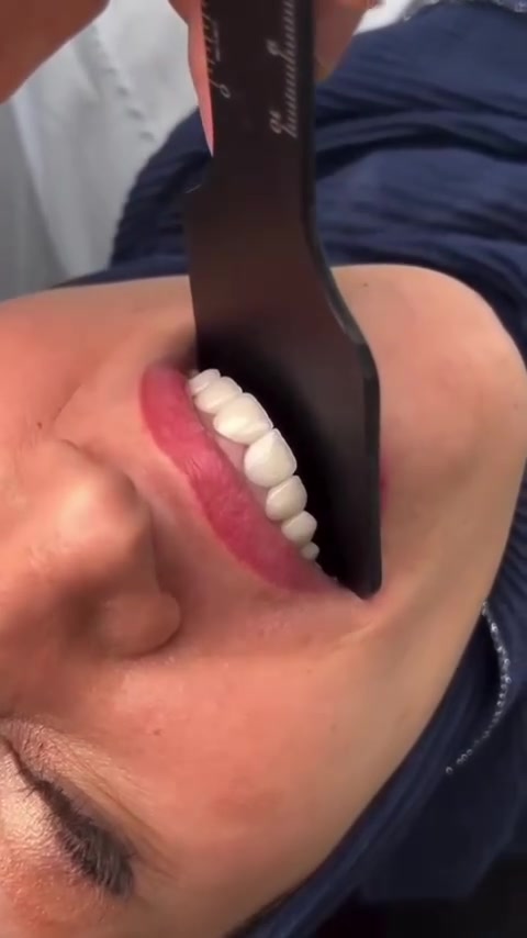 أبتسم بثقة ويا مراكز الشركة الطبية العالمية 😁😁

في مراكز الشركة الطبية العالمية ، نوفر لك أحدث تقنيات طب الأسنان، وأسهل طرق الدفع.

✅ تقويم الأسنان ✅ تبييض الأسنان ✅ ابتسامة هوليوود
زراعة أسنان 
وحشوات وكتير من الخدمات 

متواجدين داخل المركز طيلة أيام الأسبوع لخدمتكم 

  #عيادة_اسنان #طب_اسنان #كي_كارد #KeeCard #دفع_الكتروني تقويم_اسنان تبييض_الاسنان زراعة_الاسنان ابتسامة جمال صحة

العنوان : طويريج _الشارع العام_مجاور نقابة المعلمين _مقابل المكتبة العامة _مجمع الحارث الطابق الثاني 

رقم الهاتف ***********
  ***********
