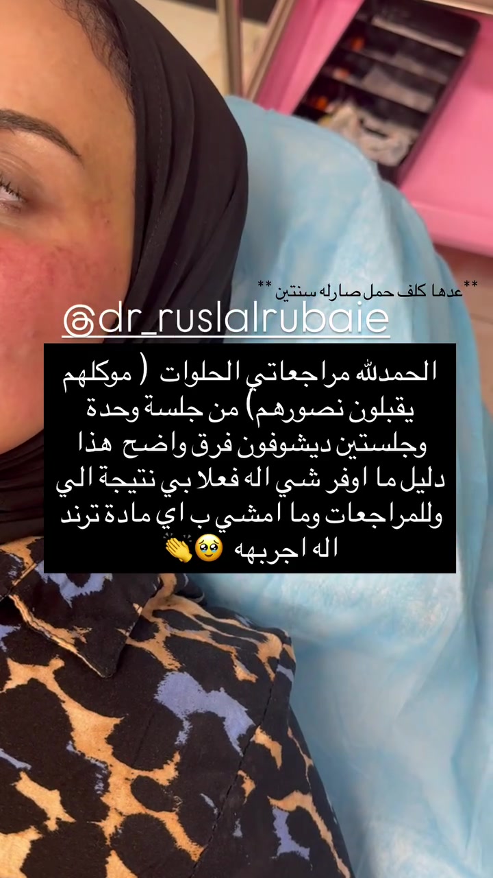 شنو رأيكم بالنتائج ؟
هاي نتيجة ما انزل اي مادة بالعياده اله واثقه منهه 💯  ومجربتها اني شخصياً !!💗💗 اهم شي المراجعات يطلعون راضيين وكل مراجعاتي جميلات 

بمناسبة قدوم موسم الاعراس👰🏻‍♀️👰🏻‍♀️ سويتلكم بكجات خاصه للعروسات والي عدهم مناسبات بكج متكامل من تنظيف بشرة الى حقن ابر نضاره كلشي بي للاستفسار والحجز مراسلتنا واتساب***********

اوعلى صفحة الانستكرام https://www.instagram.com/p/DbWWdUhsNAt/?igsh=Z2EwenVjcm5rOXFu

او صفحة الفيسبوك DrRusl Alrubaie💗👰🏻‍♀️👰🏻‍♀️👰🏻‍♀️

