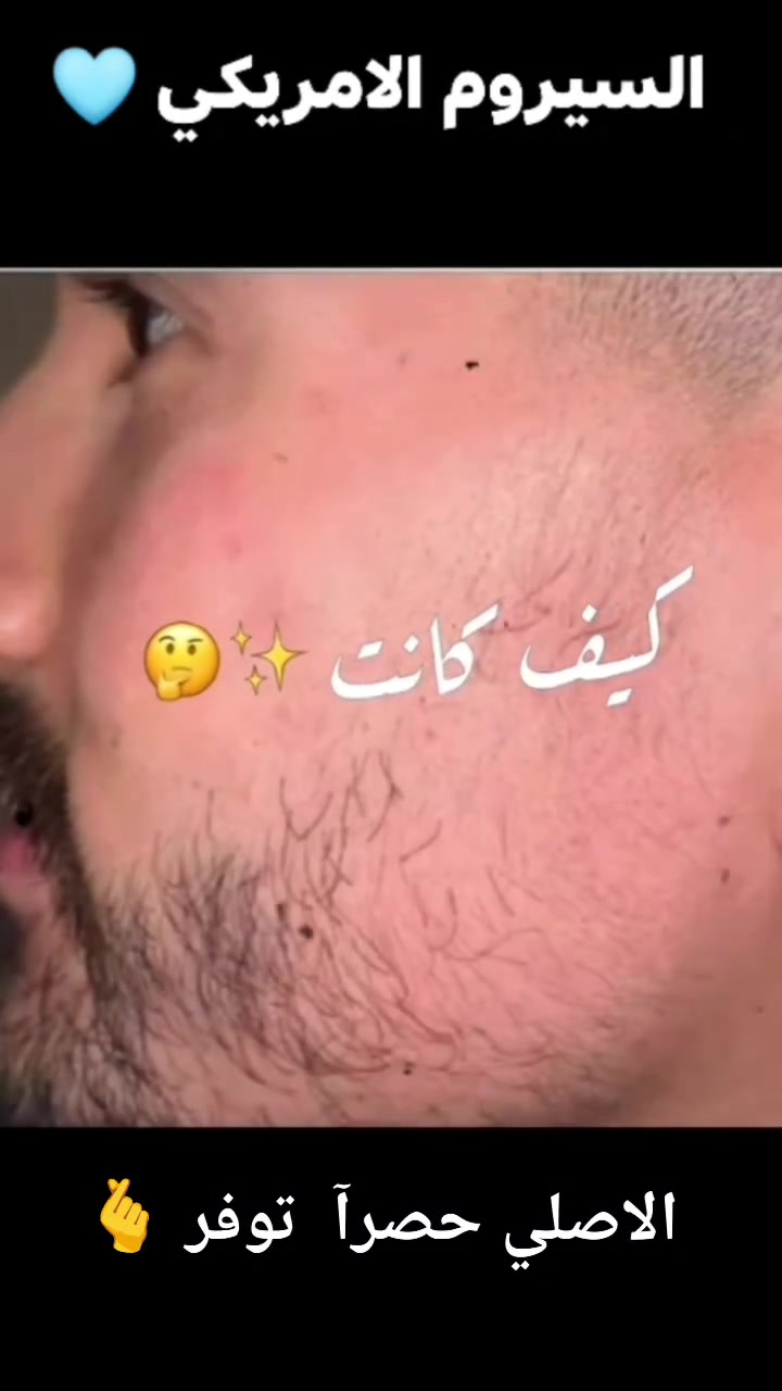 سيروم الأفعى • مينوكسيديل • تكثيف الشعر