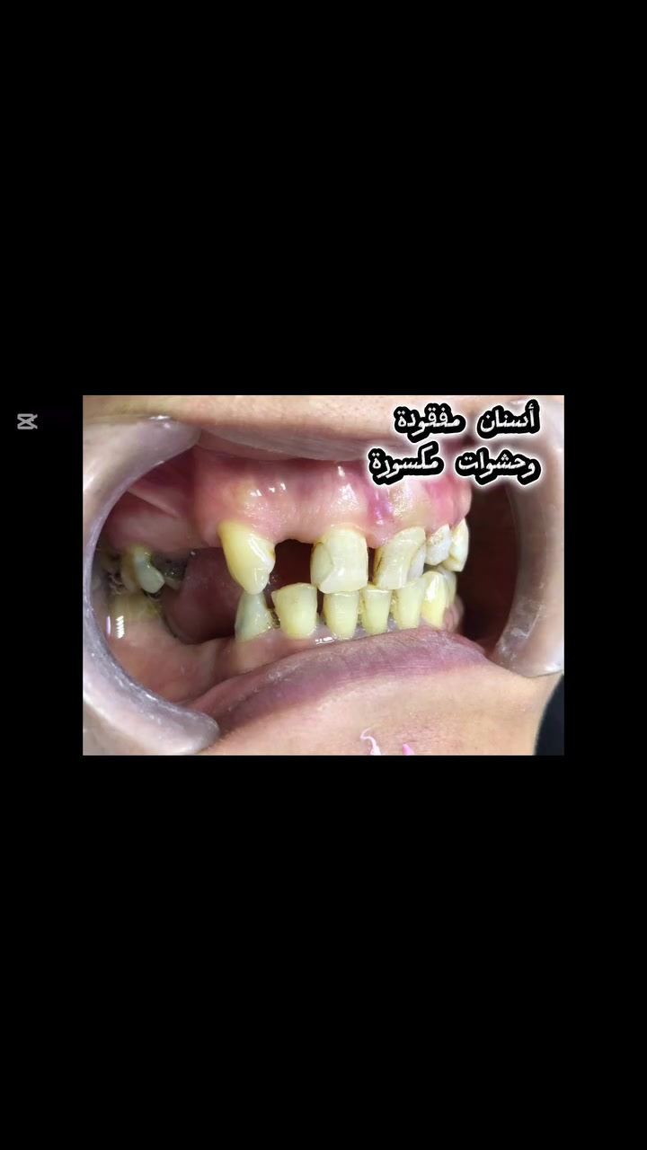 ابتسامة جديده بعيادتنا🌸
.
.
.
.
.
.
.
.

.

.
.
.
#الحيرة_شارع_اللهيبات_مجاور_صيدلية_حسن_علي_رسول
#للحجز #واتساب_***********

