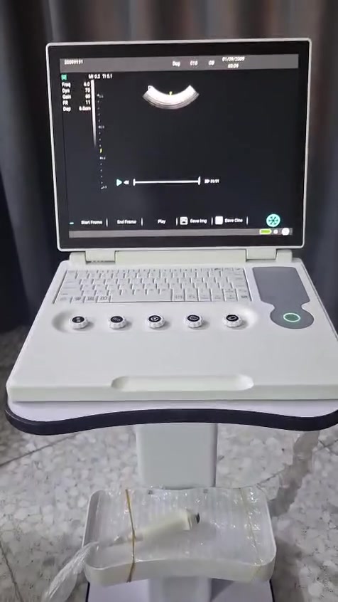 جهاز سونار بيطري نوع Youkey F6 بورتبل لابتوب ابيض واسود نظام دوبلر PW مع بروب مايكروكونفكس سنة الصنع 2024 دقة صورة عالية  مع عربة ترولي الجهاز نظيف كلش استخدام قليل وبسعر مناسب . للتواصل مراسلة الصفحة او الاتصال على الرقم *********** مهندس عماد. 
#سونار.
#بيطري
#Mindray
#Chison
