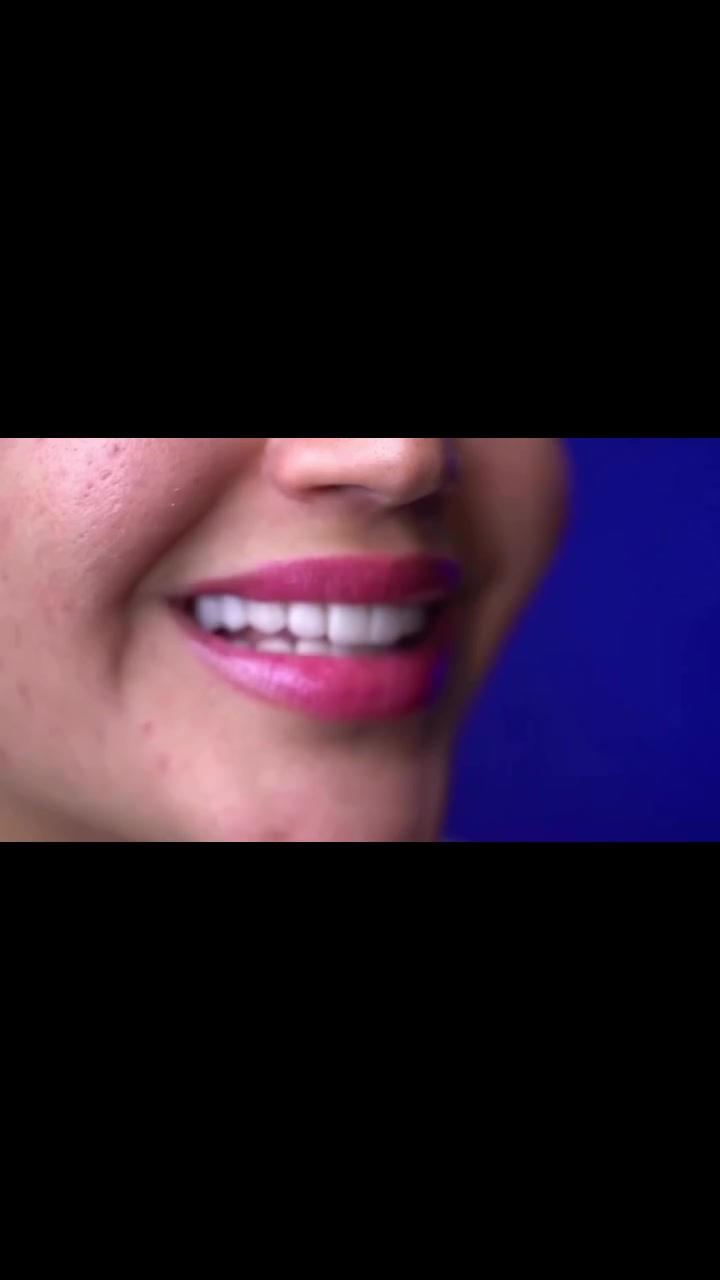 ترتيب أسنان • تغليف أسنان • الديوانية