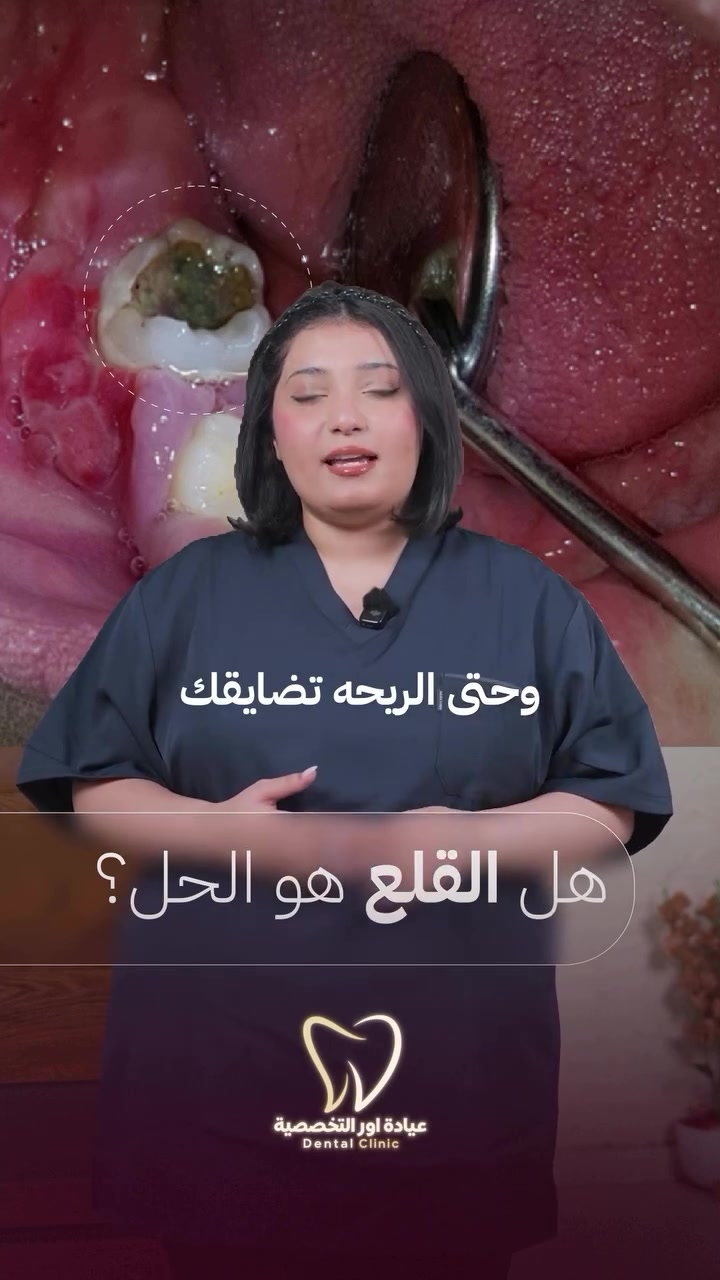عيادة اسنان • تجميل اسنان • زراعة اسنان