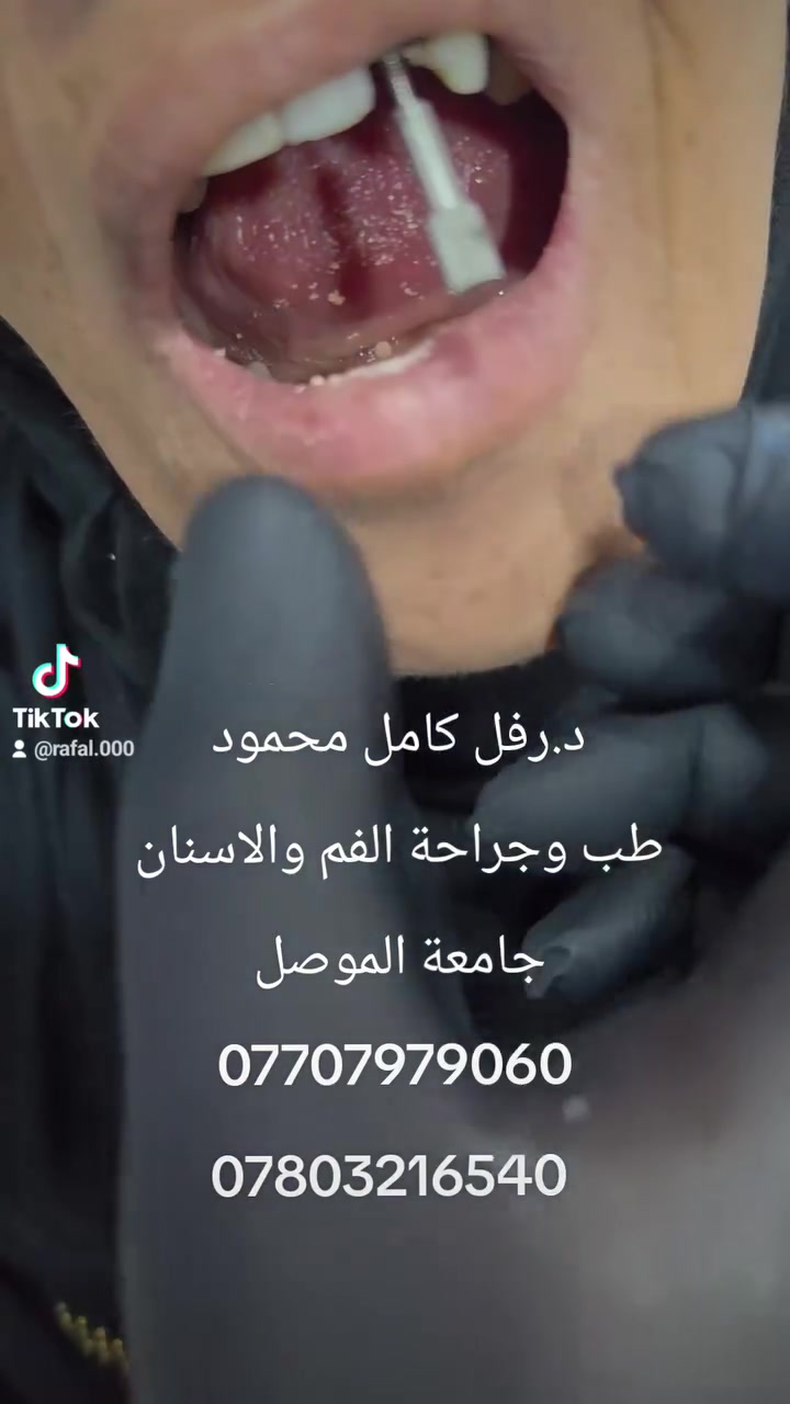 @أبرز المعجبين 
د.رفل كامل محمود 
طب وجراحة الفم والاسنان 
جامعة الموصل 
***********
***********
