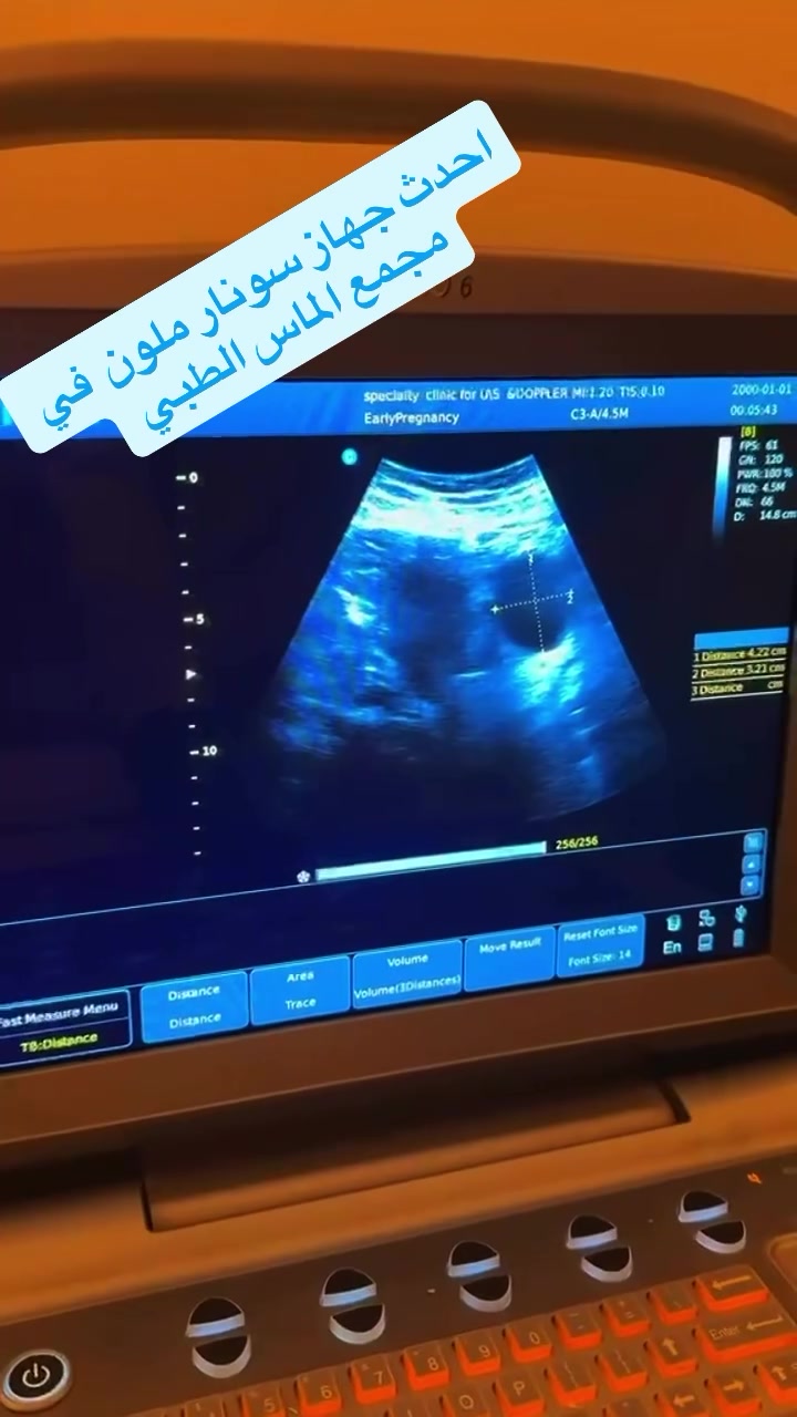 سونار ملون • عيادة نسائية • كميره