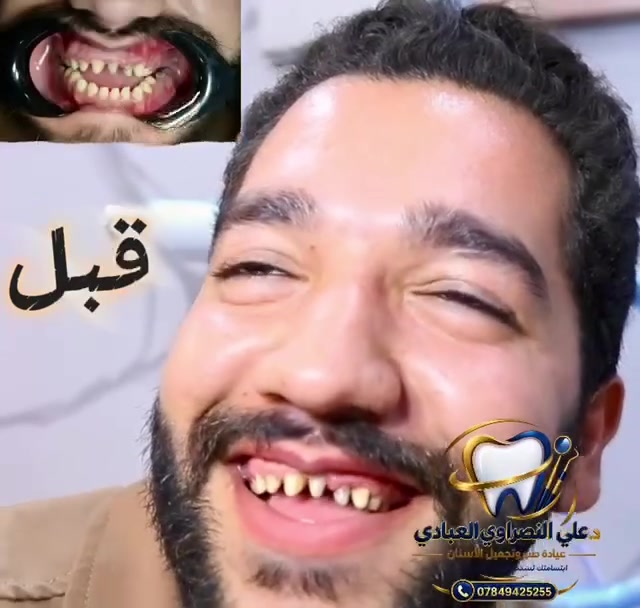 الحرية ثالثة • عيادة علي العبادي • تقسيط ماستر كارد