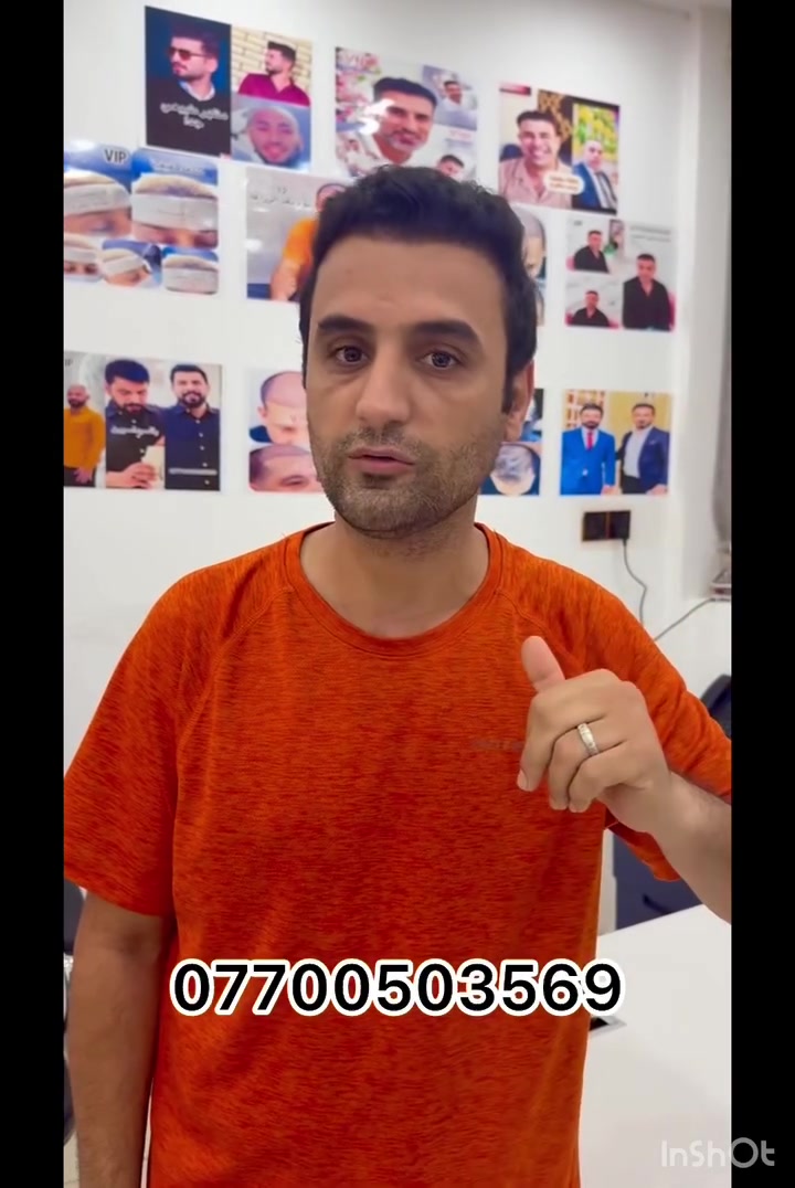 زراعة شعر • ٦ أشهر • زيونة بغداد