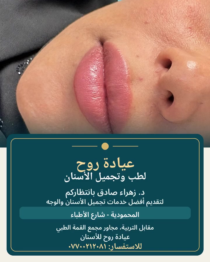 عياده روح لطب وتجميل الاسنان  د.زهراء صادق 
✨🤎فلر شفه بطريقه طبيعيه بعيدا عن بوز البطه🦢

📍📌المحموديه شارع الأطباء مقابيل التربيه مجاور مجمع القمه الطبي عياده روح  للأسنان 
للاستفسار 
***********
