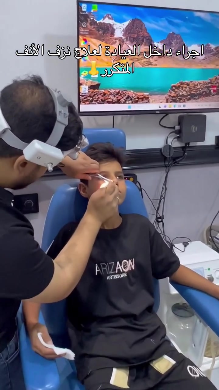 👃 كوي الأنف لعلاج نزف الأنف… متى نلجأ إليه؟

نزف الأنف المتكرر قد يكون مزعجاً، وفي بعض الحالات لا يتوقف بالعلاج الدوائي أو الإجراءات البسيطة.

لذلك قد يوصي الطبيب بـ كوي الأوعية الدموية النازفة داخل الأنف، وهي إجراء بسيط يهدف إلى:
✔ إيقاف النزف.
✔ تقليل تكرار حدوثه.
✔ علاج مصدر النزف بشكل مباشر.

📹 في هذا الفيديو تشاهدون جانباً من إجراء كوي الأنف داخل العيادة.

⚠️ لا يُنصح بمحاولة علاج نزف الأنف المتكرر دون تشخيص السبب، فقد يكون مرتبطاً بجفاف الأنف، أو إصابة، أو ارتفاع ضغط الدم، أو أسباب أخرى تحتاج إلى تقييم طبي.

👨‍⚕️ د. رياض داود العزاوي
اختصاص جراحة وأمراض الأنف والأذن والحنجرة

📍 المقدادية – حي العصري
مجاور مندي الخليج – مجمع البيضاء

📞 ***********
