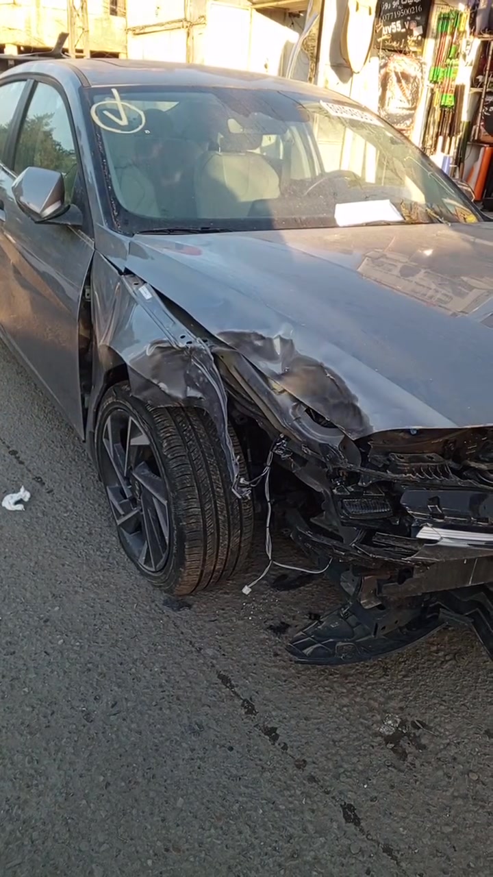 حساني الشمري لسمكرة السيارات الحديثة رقمي *********** 📞
جزء من عملنا 

سياره النترا هايبرد وارد امريكي 2024 قبل و بعد شغل درجه اولى 

اختصاصنا تعديل على البارد 

بإداره حساني السمكري 

رقمي *********** 📞📞

متواجدين ماسنجر واتساب فايبر 

العنوان العلاوي كراج ابو غريب فرع الجام مقابل مستشفى الكرامه بغداد شارع 6 🔨🔨⚒️⚒️🛠️🛠️🫡😉🤔🤫
