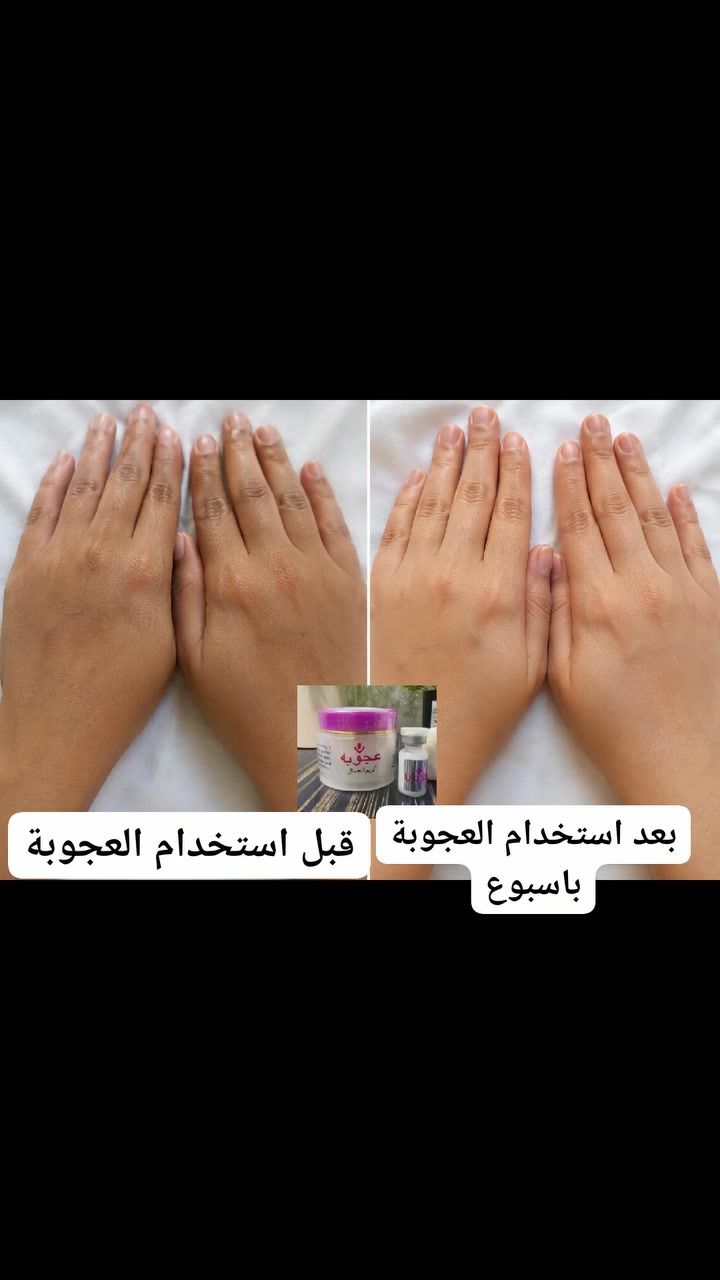 خلطة العجوبة (الاصلية) 4*1 تحتوي على (الخلطة-الصابونة-الكبسولة-الابرة) كل هاذه بسعر 18الف فقط والتوصيل مجاني لجميع المحافضات للحجز مراسلة خاص او *********** واتساب #العراق #بغداد #محافضات #عحوبة #خلطة #مبيضة #العناية #البشرة #لايك #متابعة #تعليق #مشاركة

