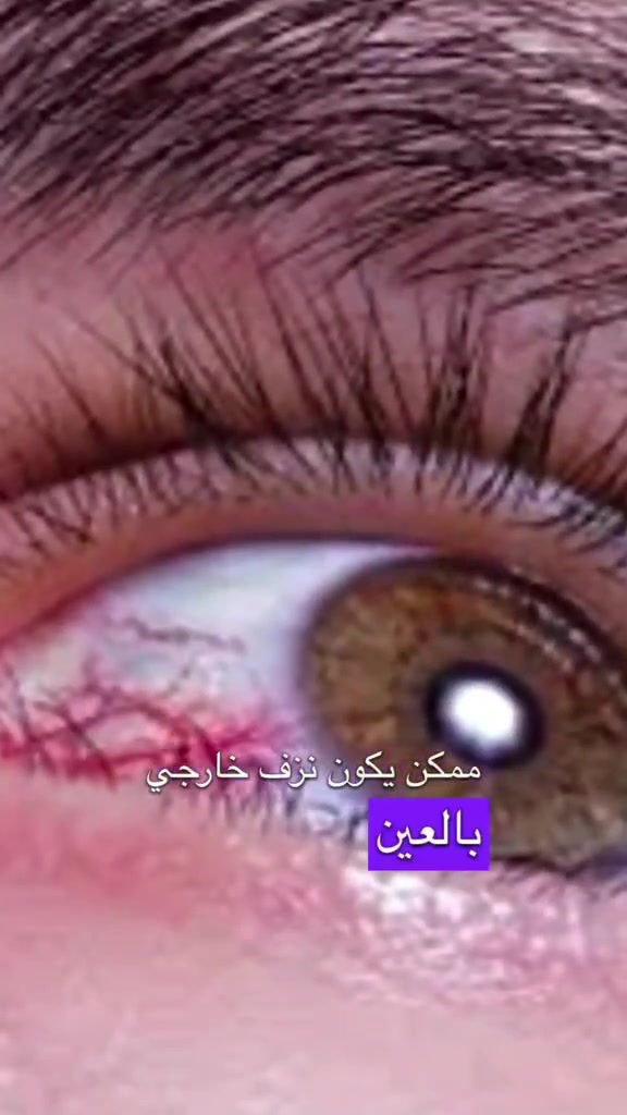دكتور عيون • المدائن • قرب البيت الأصفر