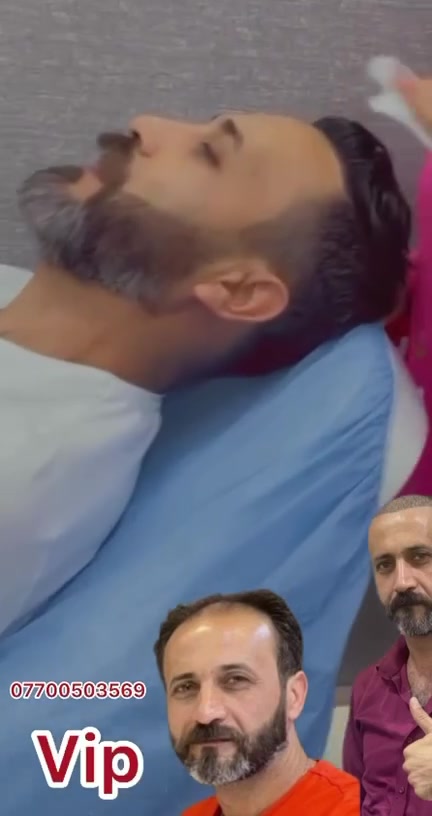هذا مو إعلان
هذا زراعة اسمها VIP
يعني الهيبة 👇

لا تسأل: شكد السعر
اسأل نفسك: شلون أختار المركز
حتى أضمن الزراعة

هذا تحذير للي يريد يزرع بسعر رخيص
اختَر الكادر
اللي يخاف على بصيلاتك
أكثر منك

إحنا نزرع بهدوء
ونطلع نتيجة تصدم
كثافة مليارية
دقّة نادرة
وشغل يختلف فعلًا عن البقية

إذا تحب الناس تعرف إنك زارع
روح لغيرنا
إذا تحب الناس تحتار
وين زارع؟ تعال يمّنا

مركز المتخصص لزراعة الشعر
عنوان النجاح

فكّر زين وخليك ويّانه
VIP اختيارك المفضّل

📞 واتساب للحجز:
***********
📞 الإدارة (واتساب):
***********
📞 واتساب للحجز:
***********
