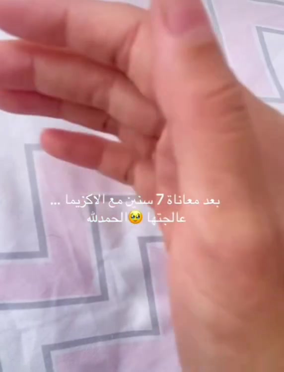 من بعد معاناة مع معالجة الاكزما احد المرضى يرسل مقطع فيديو ليديه قبل وبعد استخدام مياه وطين عيون الكبريت من حمام العليل
للطلب والاستفسار تواصل خاص او اتصل على الأرقام هاتف او وتساب *********** او ***********
