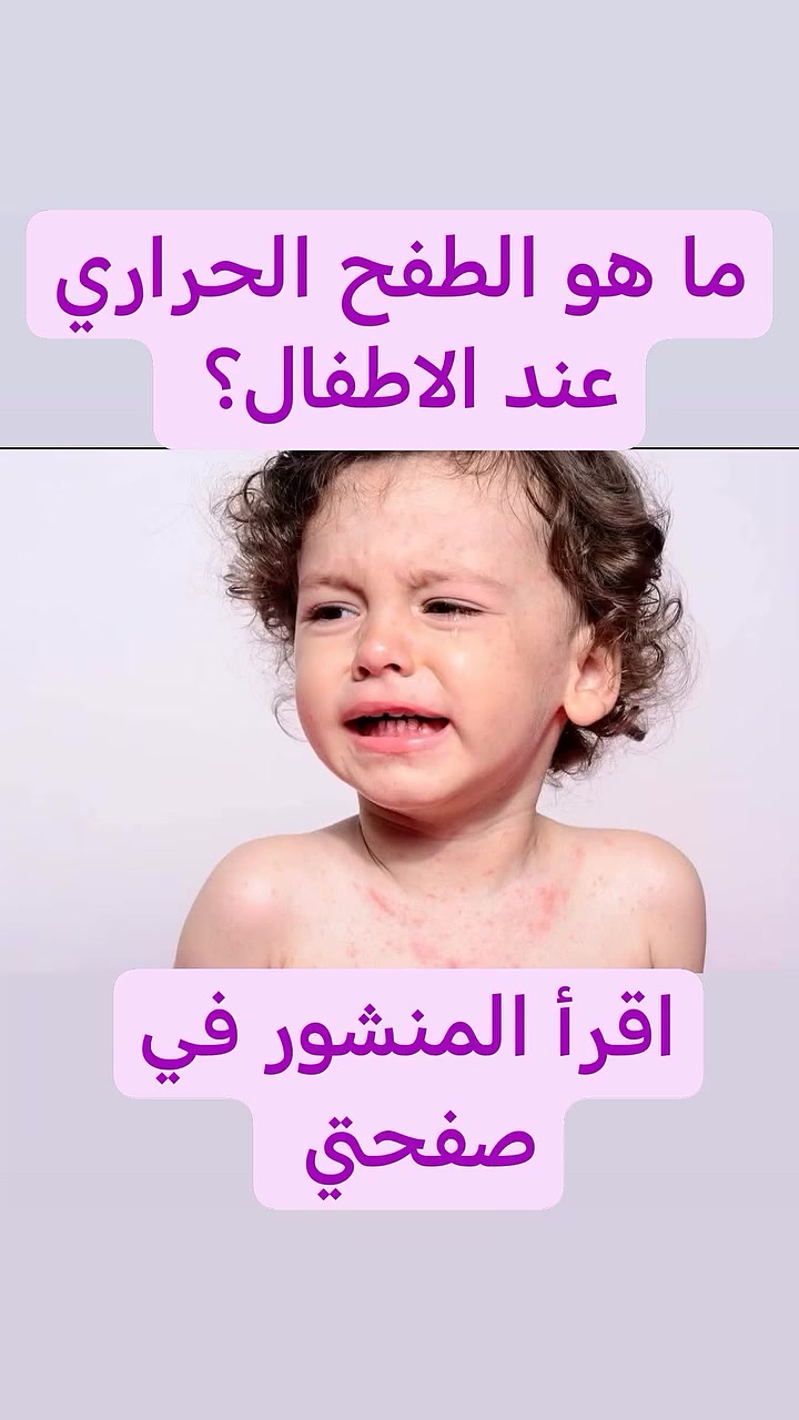 🌡️ الطفح الحراري عند الأطفال (Miliaria Rubra) 🌡️
مع ارتفاع درجات الحرارة، يزداد ظهور ما يُعرف بـ الطفح الحراري أو Miliaria Rubra، وهو شائع جداً عند الأطفال 👶

🔴 كيف يظهر؟
حبوب حمراء صغيرة
أحياناً تسبب حكة أو شعور بالحرقة
تظهر غالباً في الرقبة، الصدر، الظهر، وثنيات الجلد

🔥 ما السبب؟
انسداد قنوات العرق بسبب التعرّق الزائد، خاصة في الأجواء الحارة والرطبة

✅ كيف نتعامل معه؟
إبقاء الطفل في جو بارد ومهوّى
ارتداء ملابس قطنية خفيفة
تجنب التعرّق الزائد
الاستحمام بماء فاتر
غالباً يختفي لوحده خلال أيام

⚠️ متى نراجع الطبيب؟
إذا استمر لفترة طويلة
أو ظهرت علامات التهاب (احمرار شديد، إفرازات، حرارة)

💡 نصيحة: الوقاية أهم من العلاج… حافظوا على برودة جسم الطفل دائماً

الدكتور 🩺
احمد محمود عبدالله
طبيب الأطفال والخدج وحديثي الولادة
العنوان
بغداد حي الحسين مجمع التقى الطبي قرب مجمع النمور مقابل كوزمتك الفرج

للحجز والاستفسار
واتساب أو فايبر
***********

نعتني بصحة أطفالكم دائماً 🌷

