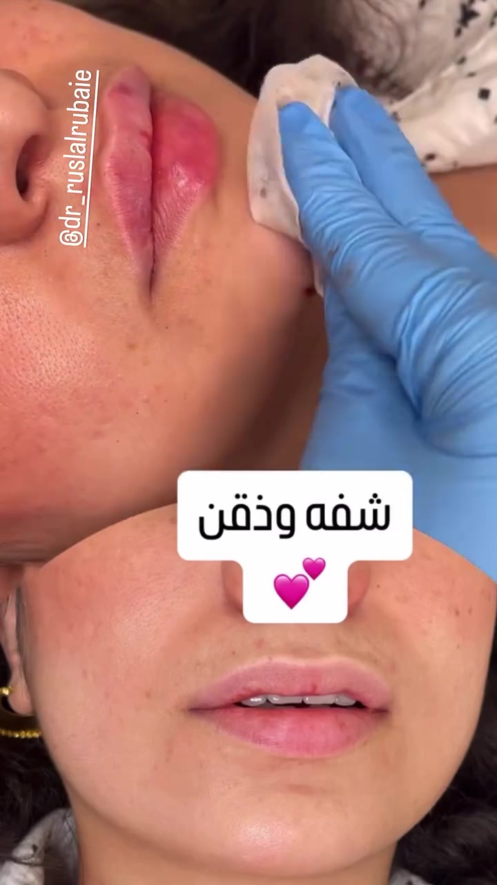 هواي دزيتولي على عروض
فرحة الزهرة وموسم اعراس وحفلات ونريد نفرح تدللون

بعد مانزلت ان توفرت ماشاءالله المسجات متوقفت💗 بس هالمرة الكمية تكفي الكل ان شاءالله وكلكم تلحكون تسوون تغييرات حلوة والعروض مستمره بلشت من اليوم 

 خلص العروض صارت جاهزة 
ومراح تتكرر ابداً هيج عروض لان بيها جلسات فري 🎁 تستفادون منها كلش هواي خصوصا الي يحتاجون عدة جلسات 🎁💗

بس لخاطرر تفرحون بمناسباتكم وتسوون كلشي عاجبكم

والمهم المواد مسجلة ومفحوصه من وزارة الصحة 
العروض تكدرون تراسلونا على الدايركت او على الواتساب مسج
***********

العنوان المسيب شارع البلدية تواجدي يكون ايام معينة بالمسيب وباقي الايام كلها بغداد لذلك يرجى الحجز قبل الحضور 💗🎁
