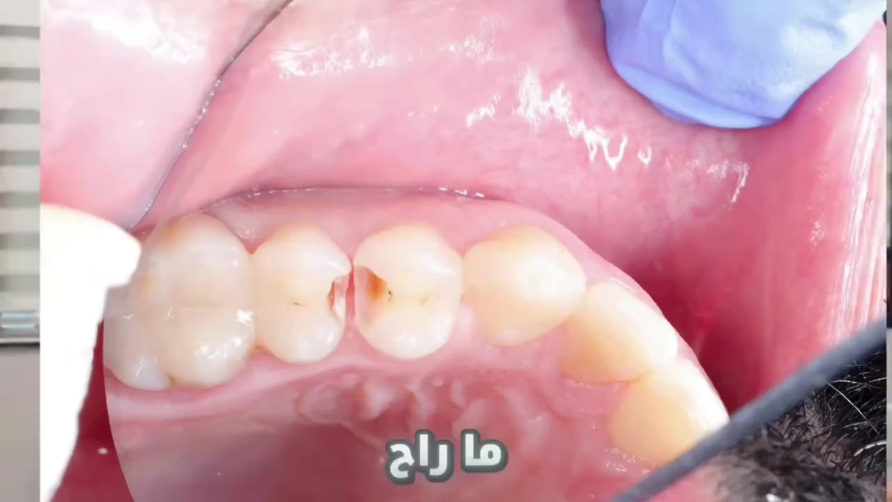 العيادة مفتوحة طيله أيام الأسبوع من الساعة 3-9 مساءآ  
سبع البور شارع الألف مجاور شركة القشلة 
رقم العيادة للحجز والأستفسار ***********
