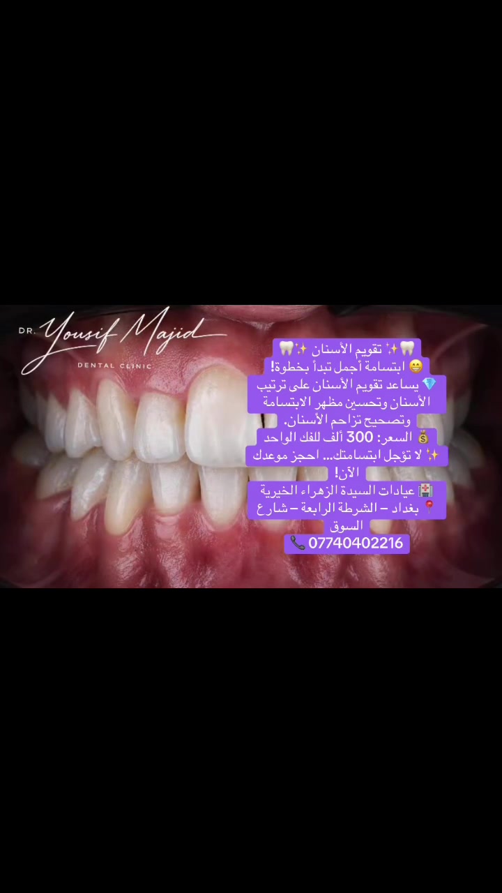 لا توجد تفاصيل
