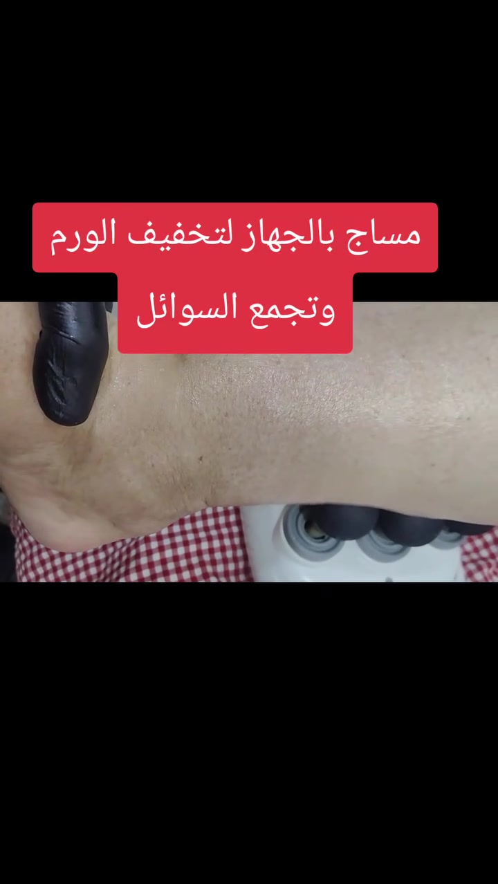مساج عن طريق جهاز المساج لتخفيف الورم وتجمع السوائل 
مع تمنياتي بالشفاء لجميع المرضى💙
#علاج  #الام_الرقبه #آلام_الظهر 
و#مرضى #الشلل_الدماغي و#الشلل_الوجهي(اللقوة)   و#الاصابات_الرياضية  و#شلل_الاطفال و#ضعف_العضلات_الحركية_للاطفال 
#جلسات_منزلية
#العلاج_الفيزيائي #العلاج_الطبيعي 
داخل #اربيل اربيل   #للتواصل  #***********
