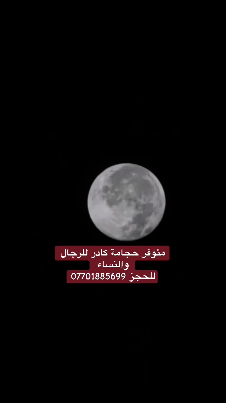 من فوائد الحجامه🫐

🍒بتسحب الدم الراكد والسموم من تحت الجلد فتخفف الحمل على الكبد والكلى. 

🍒بتحرك الدورة الدموية فالأكسجين يوصل لكل خلية. 

🍒بتقلل الالتهاب بتطلع مواد اسمها "سيتوكينات" بتقلل الوجع

🍒بتقوي المناعة بتنشط كرات الدم البيضاء

🍒بتفرغ طاقة التوتر الضغط العصبي بيتخزن في العضلات والشفط بيفرغه

🍒بتحسن المزاج وبتزود إفراز الإندورفين "هرمون السعادة" 

🍒بتقلل القلق والأرق عشان بتنشط الجهاز العصبي الباراسمبثاوي اللي هو بتاع "الراحة
 
🍒 بعد الجلسة بيحس المحتجم بخفة ونشاط 
ناس كتير بتقول "حسيت كأن شيلت جبل من على ضهري" بعد الجلسة

🍒بتعمل "تفريغ طاقي الطب الصيني بيقول إن الحزن والغضب والصدمات بتتحبس في الجسم كـ "ركود طاقة". الحجامة بتسحبها. 

🍒بتصفي الذهن لما الجسم يكون في أفضل حالاته يستطيع العمل والعبادة وكل وظائفه بشكل أفضل 

🍒بتدي إحساس بالتطهير كأنك عملت "ريستارت" للجسم والطاقة.
مركز هشام العطار للطب التكملي 
للحجز او الاستفسار *********** واتس
