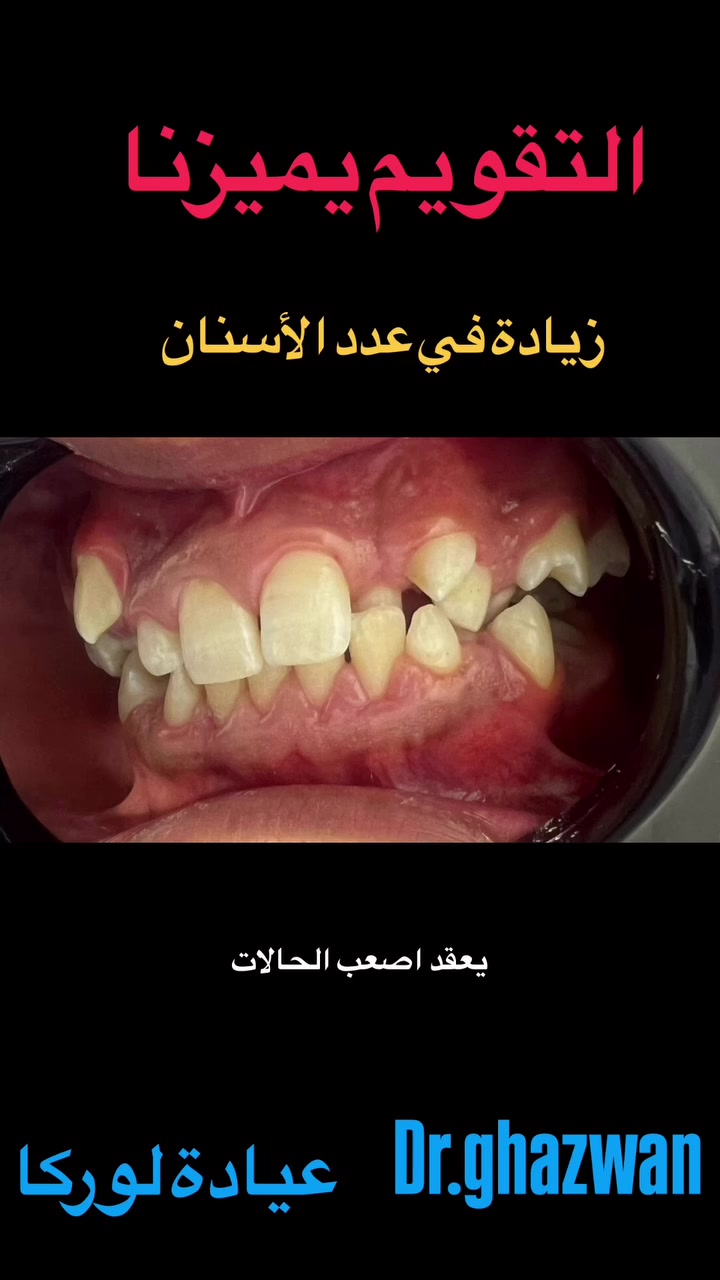 لا توجد تفاصيل
