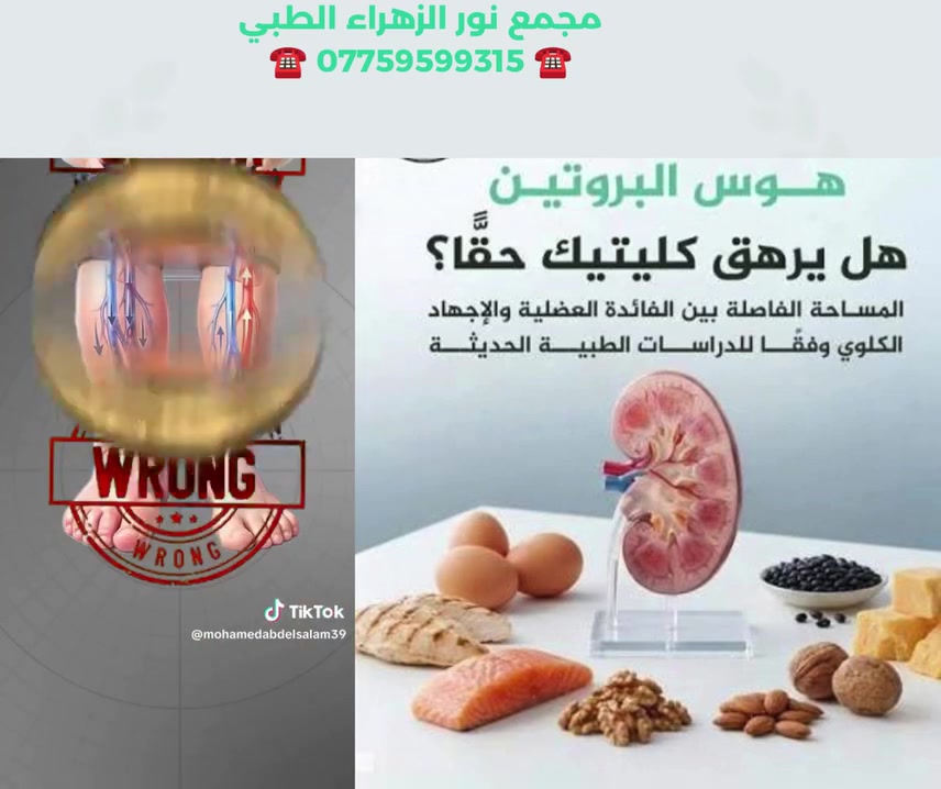 هل البروتين يهللك كليتك !!!!!!
💚❣❣📍عنوان العيادة
بغداد_المشتل_شارع المطبك _مقابل مصور طرابلس_مجاور صيدلية نور عبد الله الزلزلي
🏥مجمع نور الزهراء الطبي
☎️للحجز والاستفسار
***********
#ألكلى#البروتين
