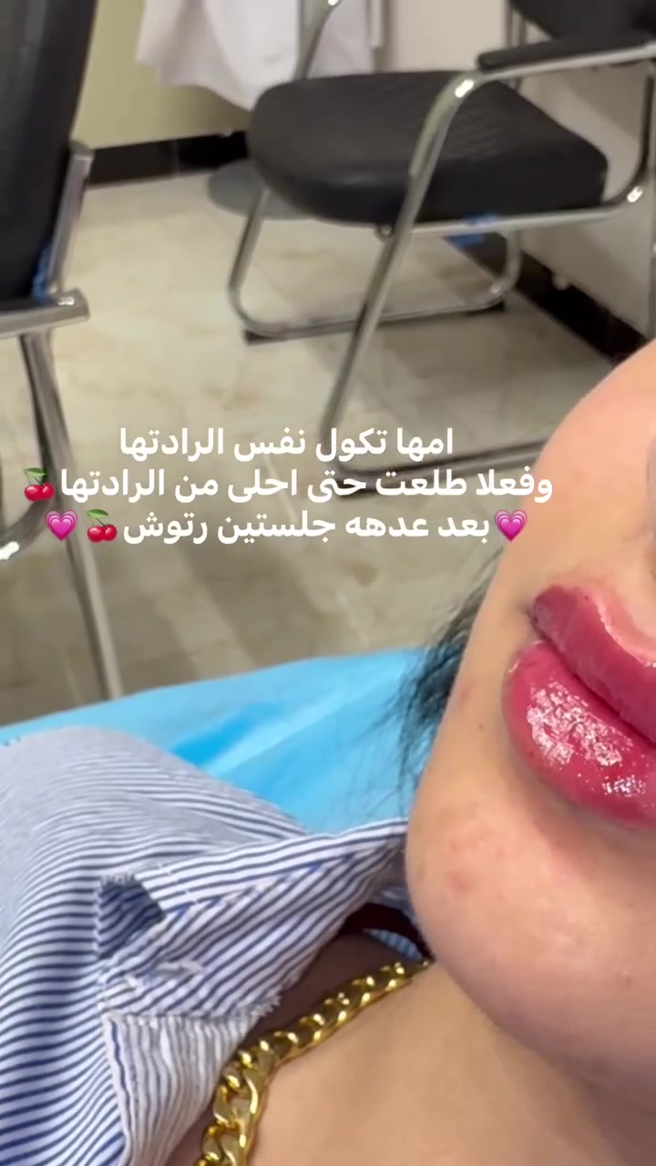 شنو رأيكم بالنتائج ؟
هاي نتيجة ما انزل اي مادة بالعياده اله واثقه منهه 💯  ومجربتها اني شخصياً !!💗💗 اهم شي المراجعات يطلعون راضيين وكل مراجعاتي جميلات 

بمناسبة قدوم موسم الاعراس👰🏻‍♀️👰🏻‍♀️ سويتلكم بكجات خاصه للعروسات والي عدهم مناسبات بكج متكامل من تنظيف بشرة الى حقن ابر نضاره كلشي بي للاستفسار والحجز مراسلتنا واتساب***********

اوعلى صفحة الانستكرام https://www.instagram.com/p/DbWWdUhsNAt/?igsh=Z2EwenVjcm5rOXFu

او صفحة الفيسبوك DrRusl Alrubaie💗👰🏻‍♀️👰🏻‍♀️👰🏻‍♀️
