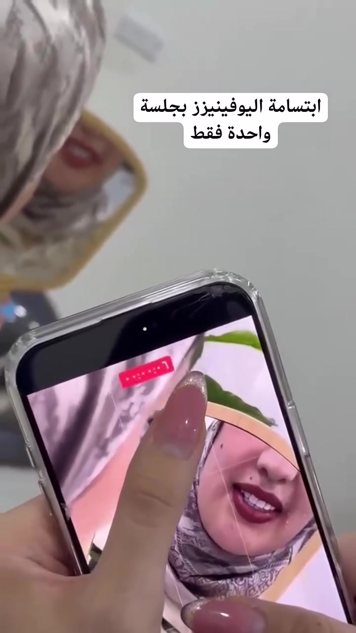 ابتسامة اليوفينيزز بجلسة واحدة فقط …🫶🏻🦷
عنوان العيادة 🦷🤍✨

الرمادي _شارع المستودع _مجمع زهرة اليقطين مبنى الضريبة القديمه نفسها قرب كراج التاميم 
 

للحجز والاستفسار الاتصال ع الرقم: ***********
او مراسلة صفحة العيادة 

أوقات الدوام من الساعة من ١١ صباحاإلى الساعة ٩ ليلا
