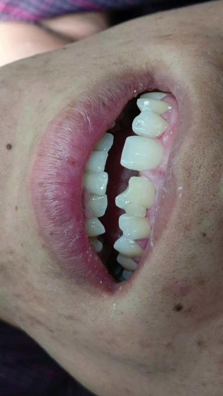 ✨ ابتسامتك تستاهل الأفضل ✨

أسنان نظيفة، لامعة، وابتسامة تخليك أكثر ثقة 💙

🦷 تنظيف الأسنان
🦷 إزالة التصبغات
🦷 حشوات تجميلية
🦷 تبييض الأسنان

احجز موعدك *********** واتساب ✨
