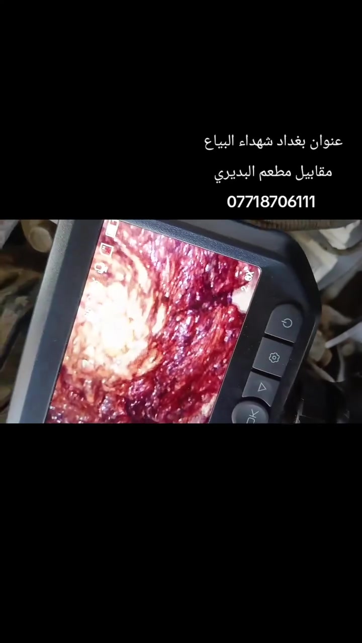 النترا فحص كازگيت 
راديترات ولصالنصات وغسل السلندر بجهاز الألي راديتر وفحص كازكيت وتنظيف حجر بيئه بحدث الأجهزة 
عنوان شهداء البياع مقابيل 
مطعم البديري
 وتساب***********
