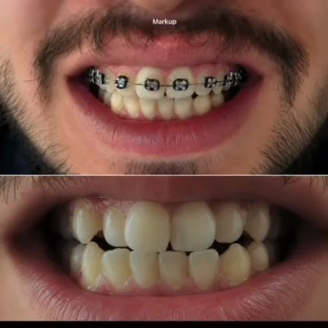 العنوان مشيرفة شوارع 60 
قرب المنديل صيدلية محمود مفكر 
الحجز التواصل
***********
