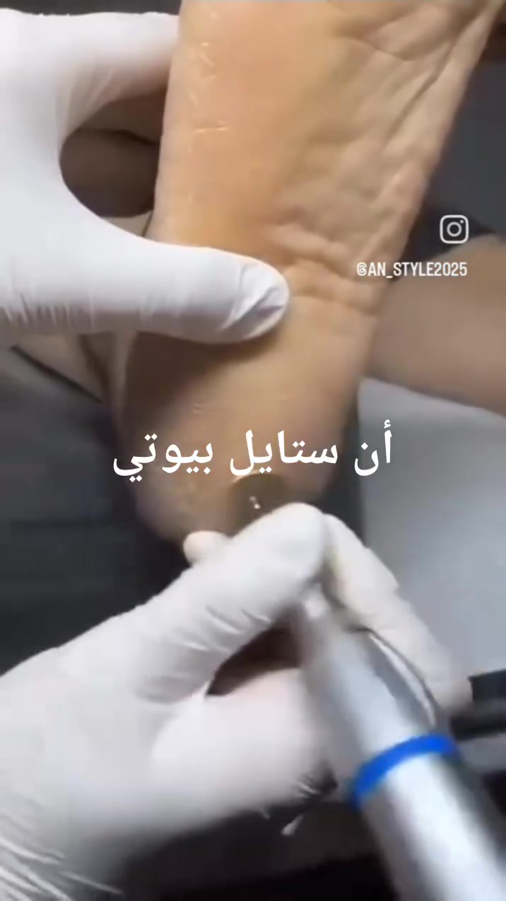 لا توجد تفاصيل
