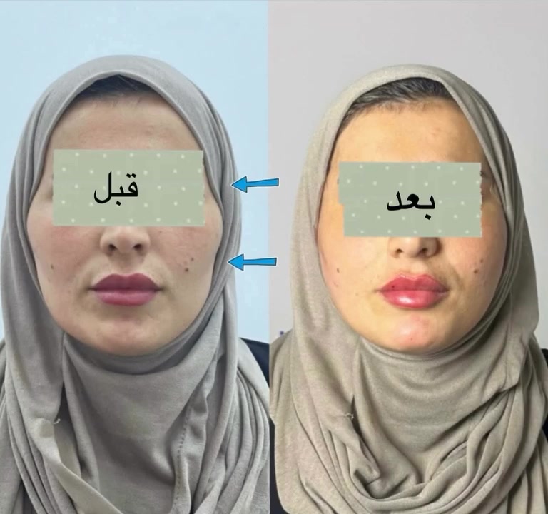 صالون تجميل • خدمات تجميل • ماكو تفاصيل