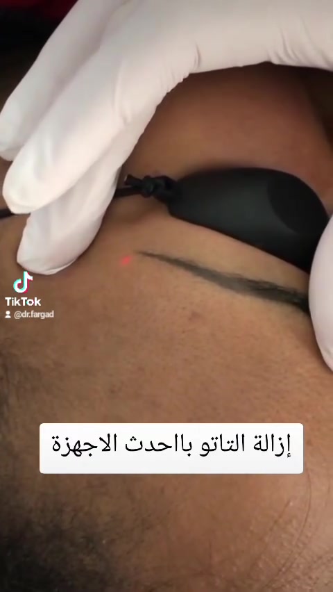 سما بيوتي • تجميل لاجراحي • بوتوكس فيلر