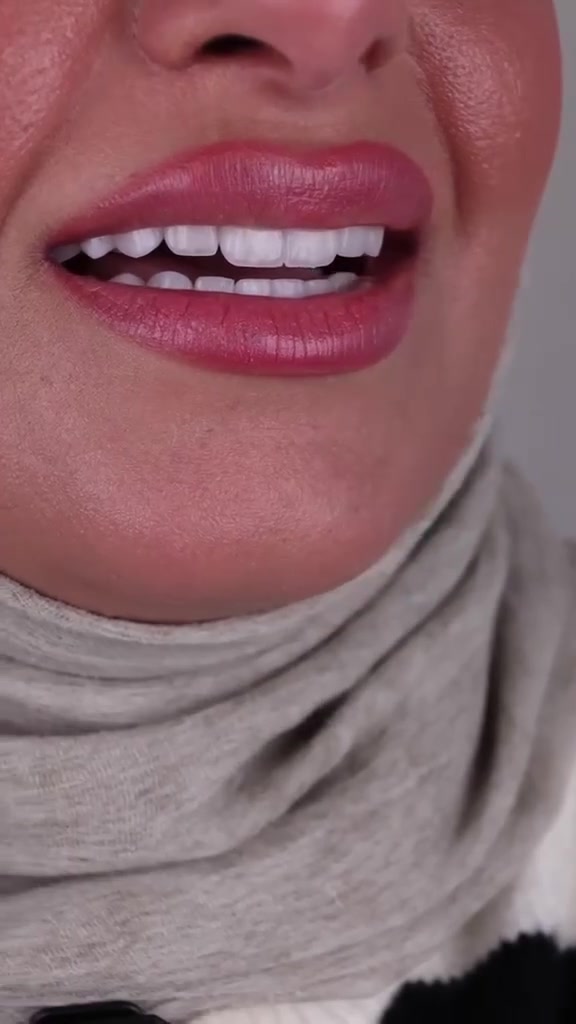 "🦷 أسنان صحية وابتسامة مشرقة...

في مراكز الشركة الطبية العالمية ، نوفر لك أحدث تقنيات طب الأسنان، وأسهل طرق الدفع.

✅ تقويم الأسنان ✅ تبييض الأسنان ✅ ابتسامة هوليوود
زراعة أسنان 
وحشوات وكتير من الخدمات 

متواجدين داخل المركز طيلة أيام الأسبوع لخدمتكم 

  #عيادة_اسنان #طب_اسنان #كي_كارد #KeeCard #دفع_الكتروني تقويم_اسنان تبييض_الاسنان زراعة_الاسنان ابتسامة جمال صحة

🔻
🏢 العنوان / بغداد _ بسماية _ الشارع العام  . مجاور ماركت الغدير 
فوق مطعم بي تاون
📲 للحجز والاستفسار 
***********
#مركز_بسماية_لطب_وتجميل_الاسنان
