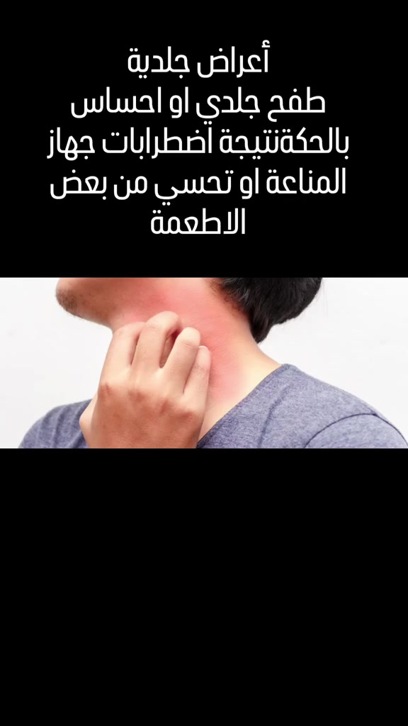 راسلني خل اساعدك تتخلص من كل هاي الأعراض
***********
​#صحة_القولون
​#التغذية_والصحة
​#نظام_غذائي
​#صحة_الجهاز_الهضمي
​#انتفاخ_البطن
