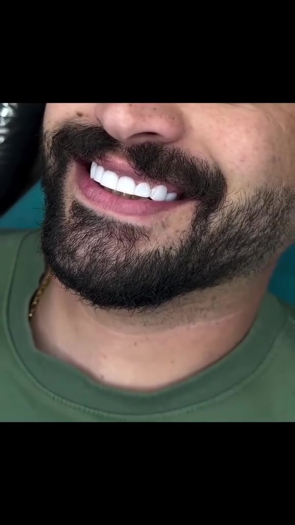 ابتسامة أحلامك أقرب مما تتوقع… مع تغاليف أسنان مصممة لتناسب ملامحك.
* 💎 ابتسامة أنيقة بتفاصيل طبيعية… لأن الجمال يكمن في البساطة
*
موقعنا.. 
البصرة المطيحة مجاور مدارس الفراهيدي ***********
