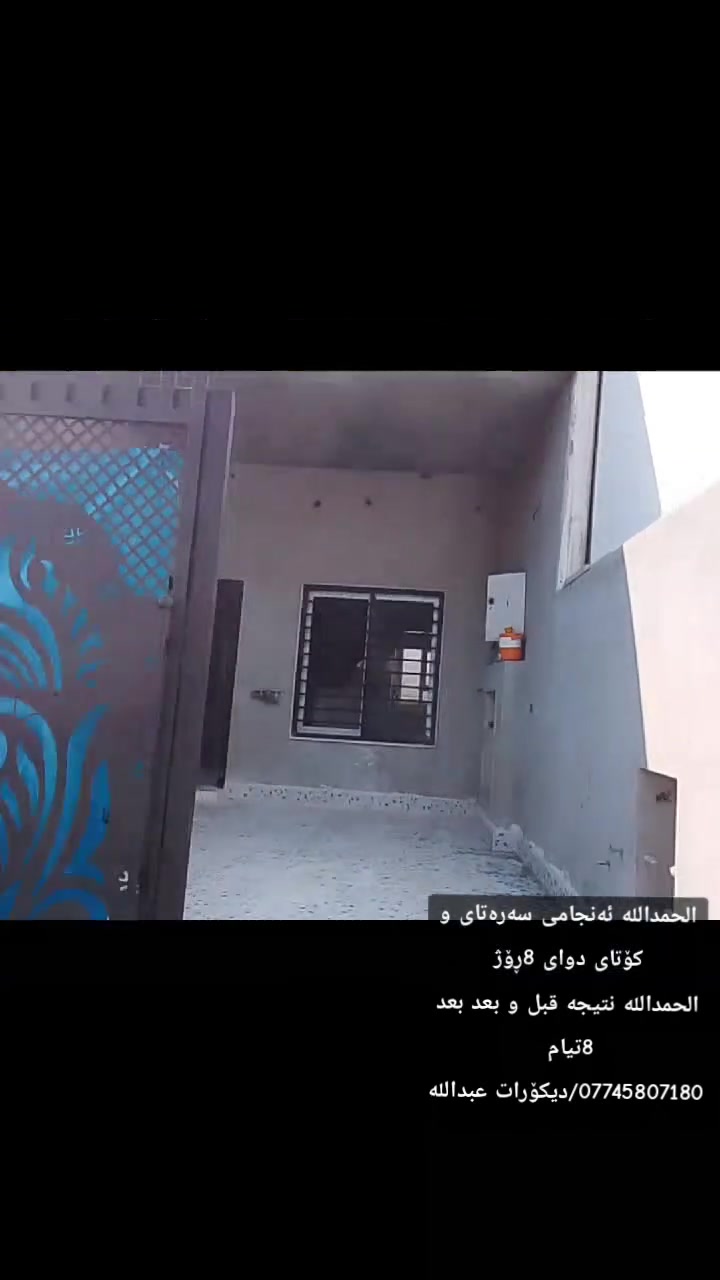 الحمداللە نتیجە دوای 8ڕۆژ 
الحمداللە نتیجە بعد 8تیام 
دیکۆرات اسطە عبداللە /***********طوز خورماتوو
