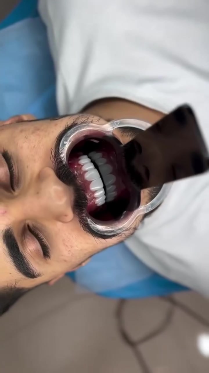"الابتسامة المثالية لم تعد حلماً؛ اكتشف جمال ابتسامتك بخدماتنا."

متواجدين لخدمتكم طيلة أيام الأسبوع  #مراكز_الشركة_الطبية_العالمية 
🔻
🏢 العنوان / بغداد _ الزعفرانية  الاربع شوارع _ مجاور مدرسة الاميرات ..
📲 للحجز والاستفسار 
***********
#مركز_سما_الزعفرانية_لطب_وتجميل_الاسنان
