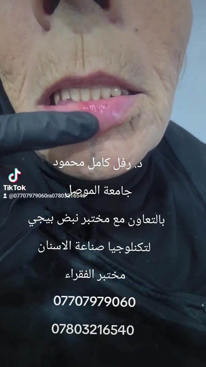 عياده طب الأسنان الدكتورة رفل كامل محمود 
الدكتورة رفل كامل الدليمي 
جامعة الموصل 
بالتعاون مع مختبر نبض بيجي
 لتكنلوجيا صناعة الاسنان 
مختبر الفقراء 
هنا نصنع الحياة 
هنا نصنع ألامل 
هنا نصنع الابتسامة.
***********
***********
