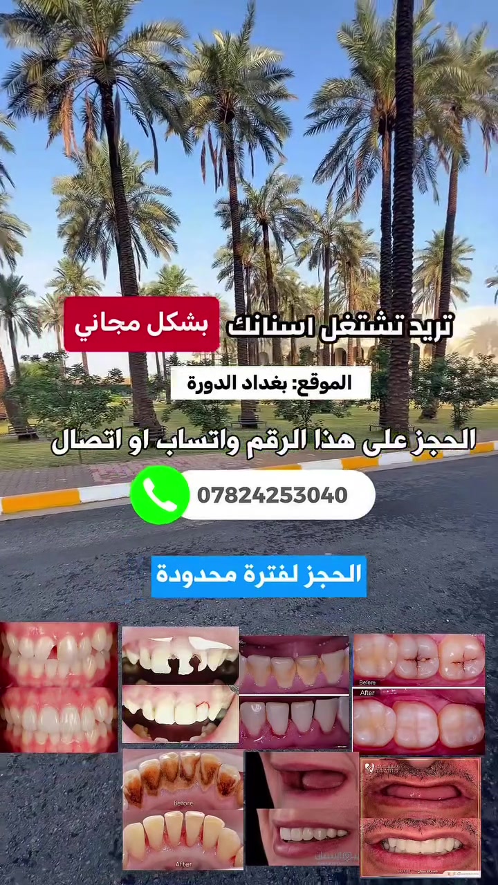 طبيب اسنان جامعة دجلة
الحجز ؛ ***********
العلاج : مجاناََ بالكامل
