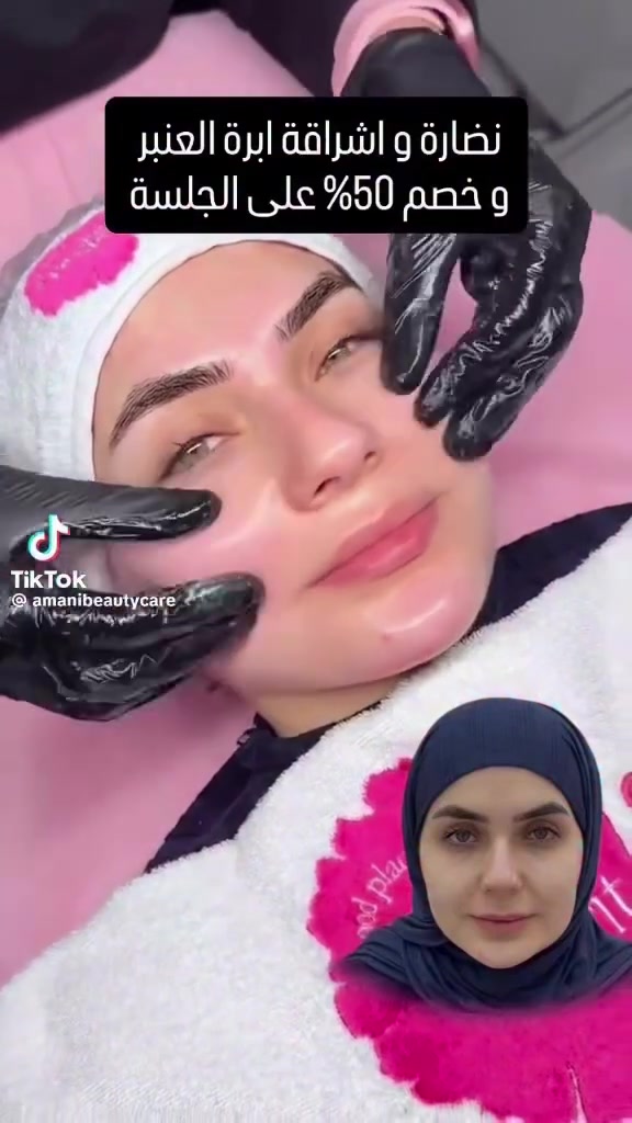 ابر العنبر • فرنسية • جلسة