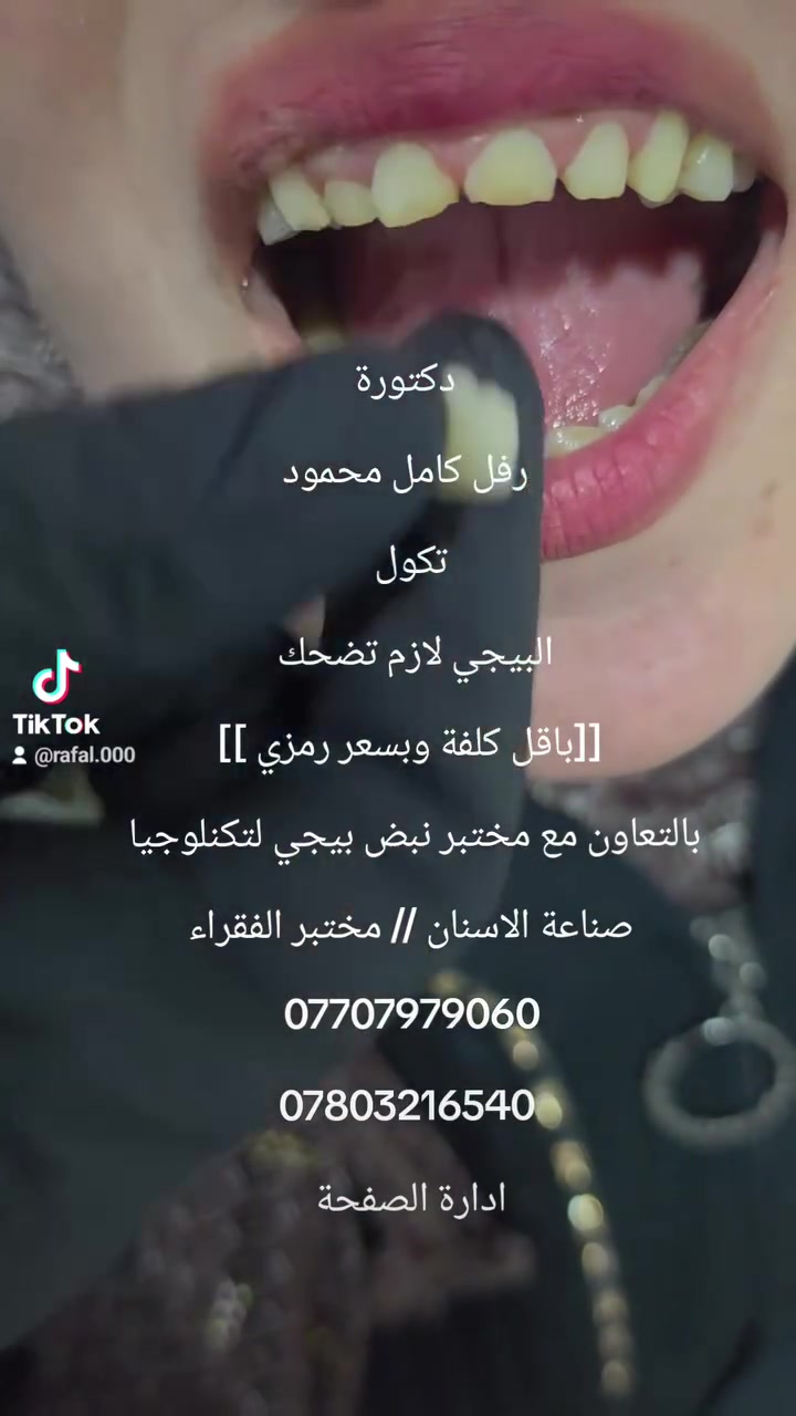 دكتورة رفل كامل محمود
تكول 
البيجي لازم تضحك 
[[باقل كلفة وبسعر رمزي]]
بالتعاون مع مختبر نبض بيجي لتكنلوجيا 
صناعة الاسنان // ((مختبر الفقراء))
***********
*********** 
ادارة الصفحة
