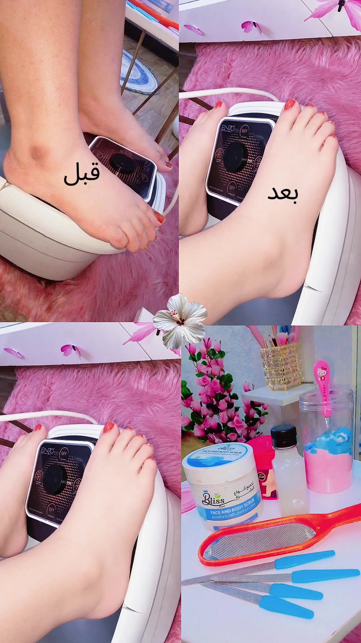 بديكير قدم • تقشير • ترطيب