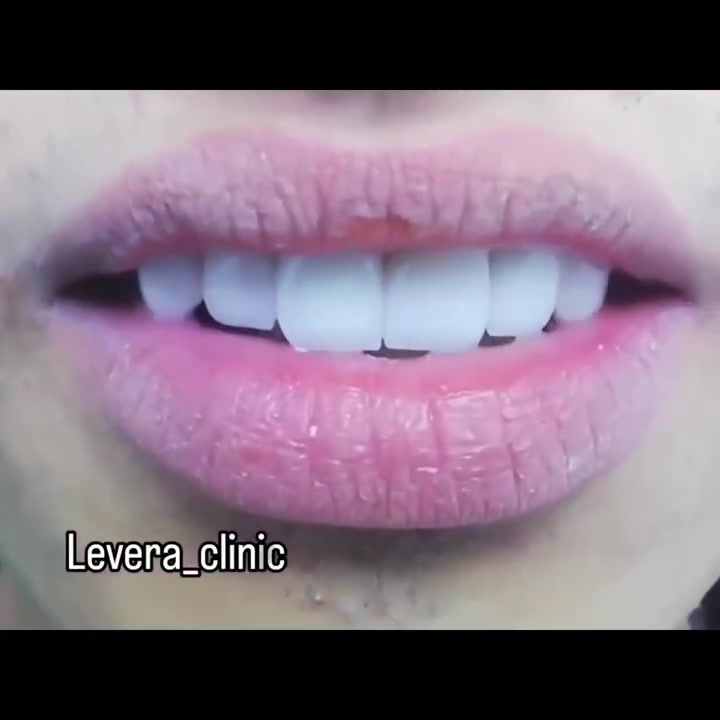 عيادة ليڤيرا لطب الاسنان والتجميل

للحجز والاستفسار ***********

