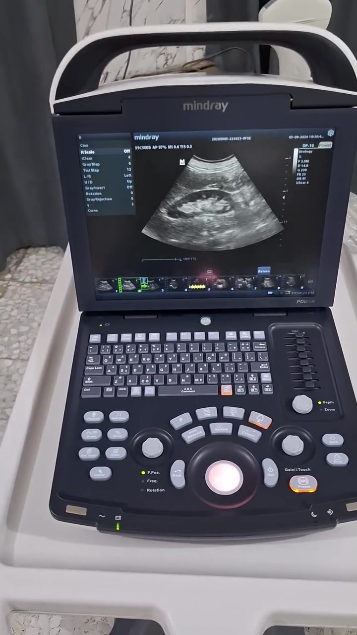 جهاز سونار ابيض واسود  Mindray DP-10 سنة الصنع 2024 مع بروب كونفكس جهاز نظيف مستعمل قليل بكارتونته مع خاصية الدوبلر  PW لقياس نبض الجنين يفيد العيادات النسائية والباطنية والبولية وبسعر  مناسب ويمكن إضافة بروب لينير او فجاينال حسب طلب الزبون . للتواصل مراسلة الصفحة او الاتصال على الرقم *********** مهندس عماد .
صور وفديوات في أول تعليق
#سونار
# Mindray
