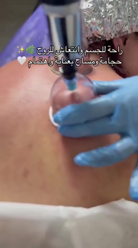 حجامة • مساج • عمليات تجميل