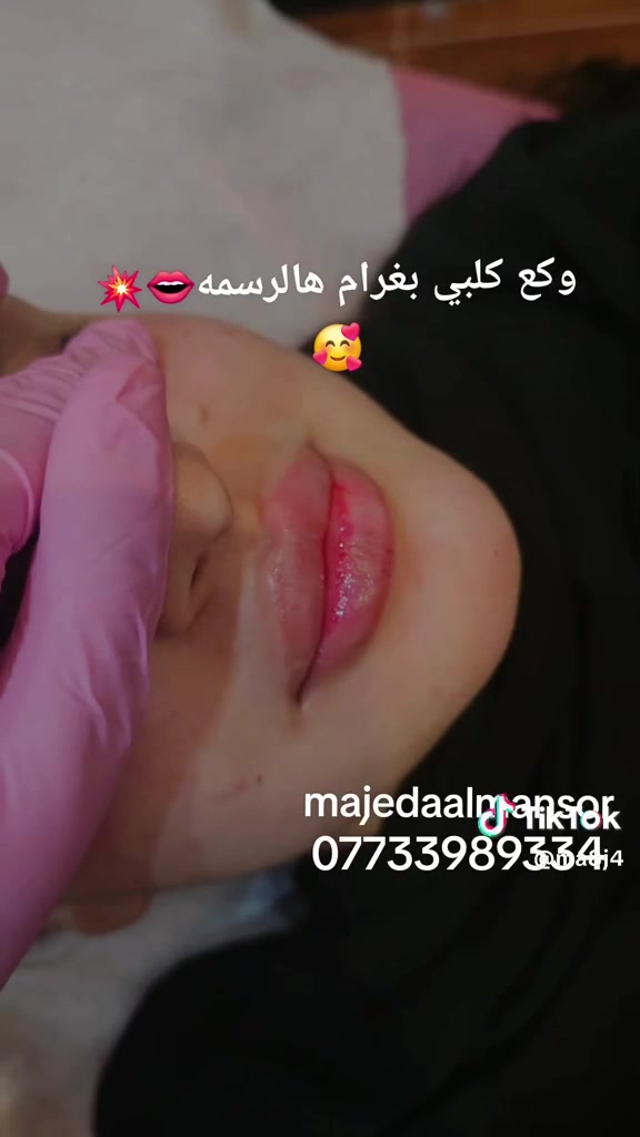 ✨ لأن جمالچ يستاهل الاهتمام ✨
💋 فيلر بايدي الدكتورة ماجدة المنصور Jojo Alnabeel 
لإبراز ملامحچ ومنحچ إطلالة مرتبة وطبيعية
💎 إبرة نضارة
لإشراقة ونضارة وترطيب البشرة
🌸 خليچ دائماً بأجمل إطلالة
العنوان بغداد الحسينية مقابل السوق الكبير مجاور مرطبات العذراء مجمع سما الحسينية الطبي الطابق الثاني 
📍 الحجز مسبقاً 
📞***********
