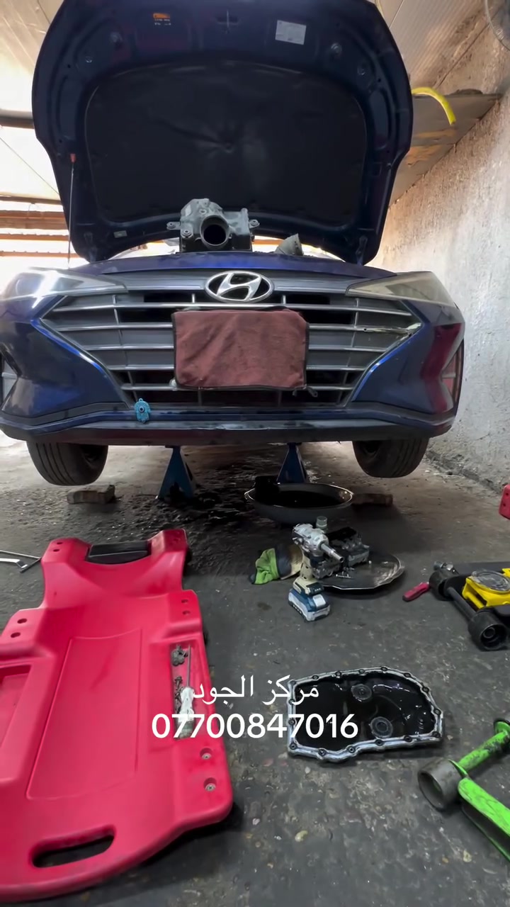 اختصاص CVT • تشخيص دقيق • الشعلة بغداد