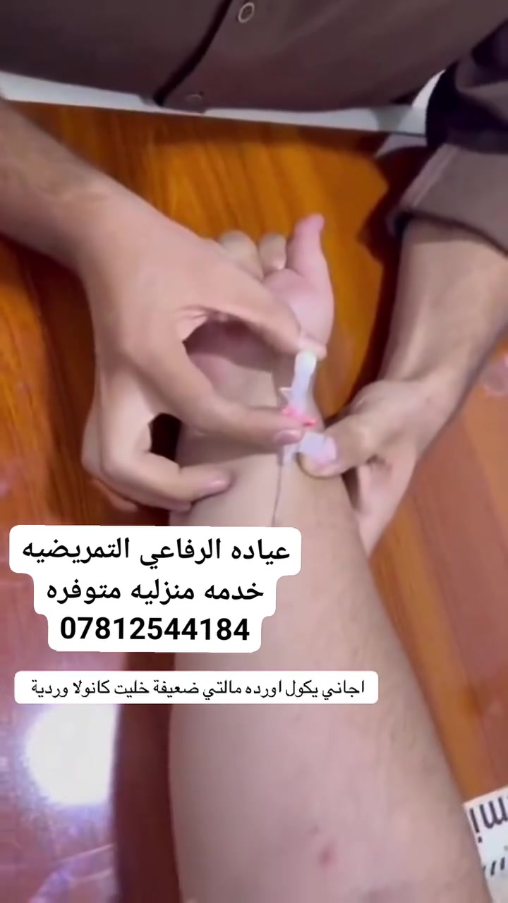 أوردة ضعيفة • علاج الأوردة • متخصص